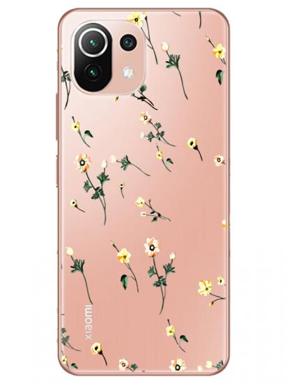 Xiaomi Mi 11 Çiçekli Şeffaf Telefon Kılıfı