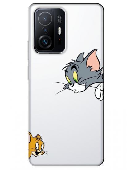Xiaomi Mi 11T Tom And Jerry Şeffaf Telefon Kılıfı