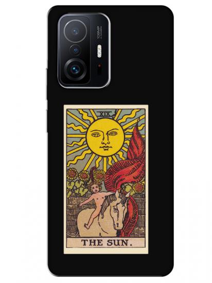 Xiaomi Mi 11T The Sun Siyah Telefon Kılıfı