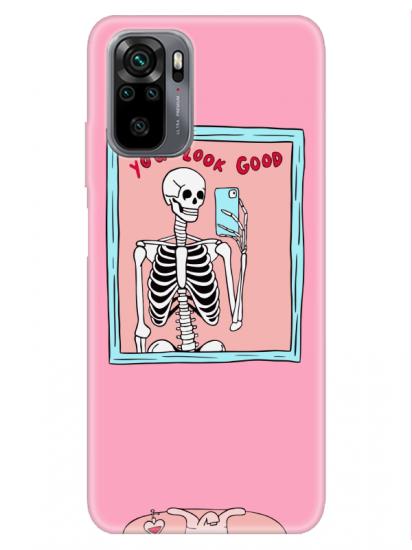 Redmi Note 10 You Look Good İskelet Pembe Telefon Kılıfı
