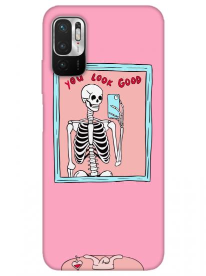 Redmi Note 10 5G You Look Good İskelet Pembe Telefon Kılıfı