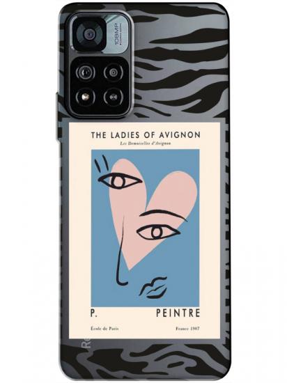 Redmi Note 11 Pro Zebra Picasso Şeffaf Telefon Kılıfı