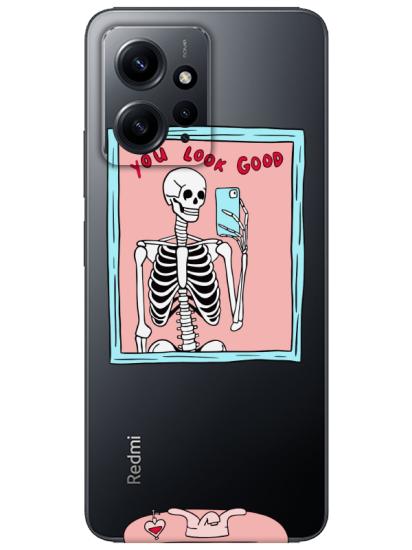 Redmi Note 12 4g You Look Good İskelet Şeffaf Telefon Kılıfı